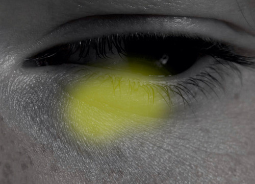 Zwart-witfoto van een oog met een gele vlek ervoor