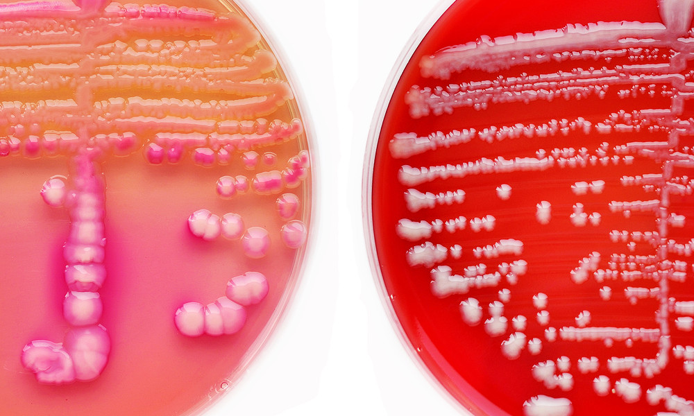 strook tegel site.jpg