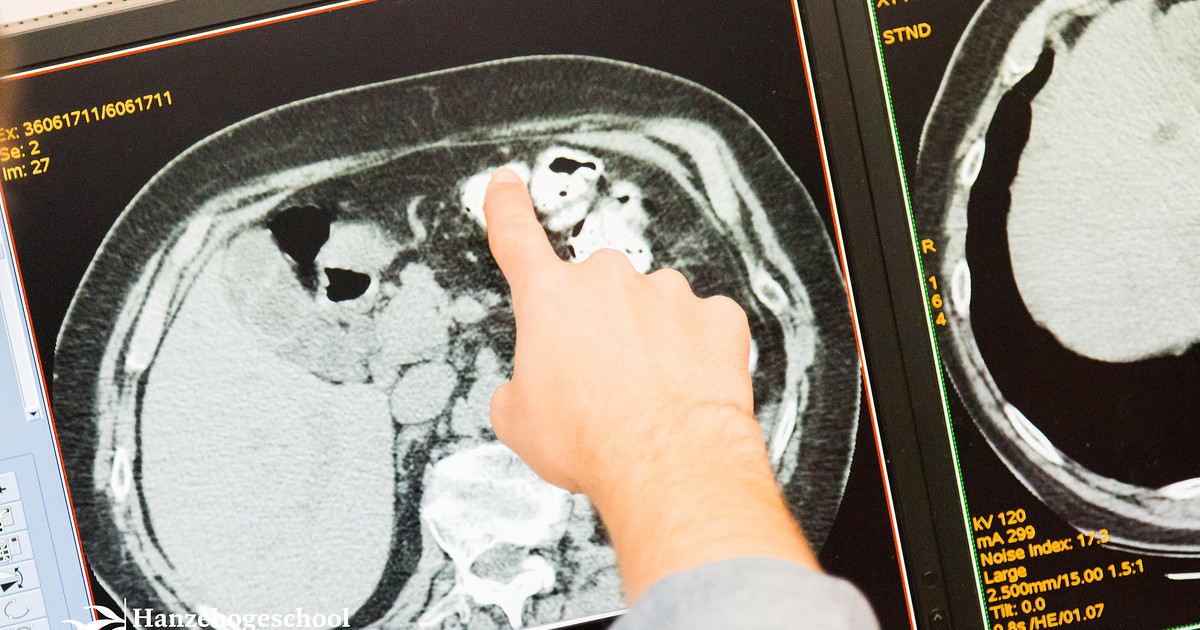 Medische beeldvorming Hanze Medische beeldvorming Hanze